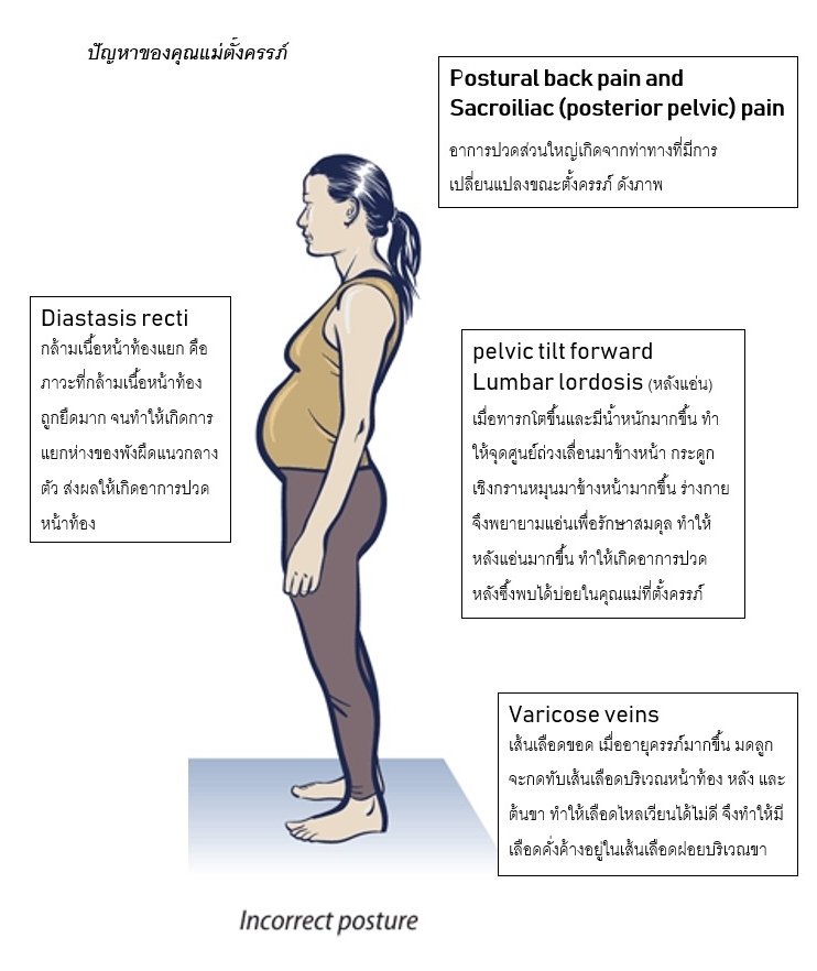ปัญหาคุณแม่ตั้งครรภ์