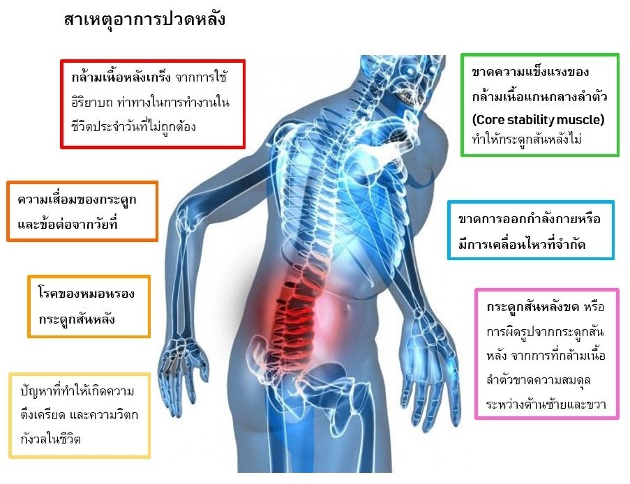 สาเหตุอาการปวดหลัง