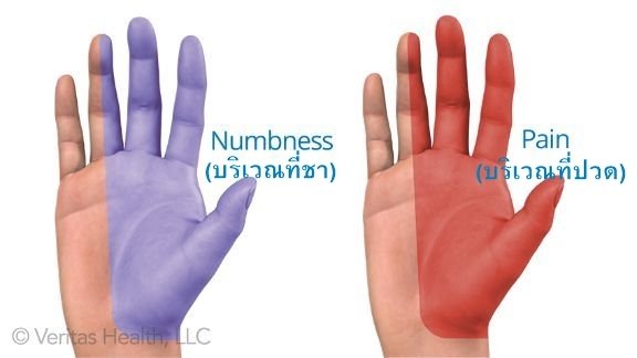 ทำงานคอมฯ จับเมาส์ เขียนหนังสือเยอะๆ ก็มือชาได้ !!!