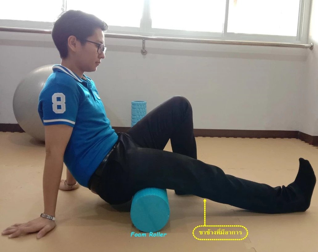 ปวดสะโพกร้าวลงขา อาการยอดฮิตของคนชอบนั่งนาน