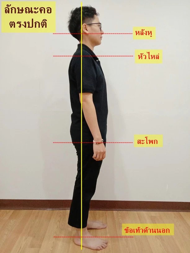 เปลี่ยนพฤติกรรมจะไม่ปวดคอเรื้อรัง