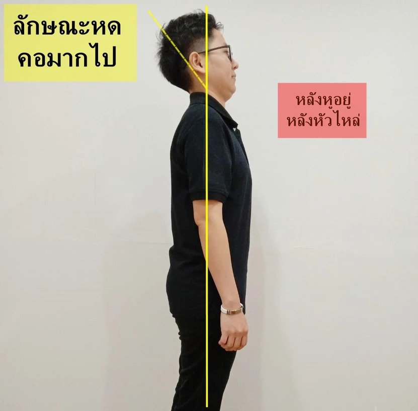 เปลี่ยนพฤติกรรมจะไม่ปวดคอเรื้อรัง