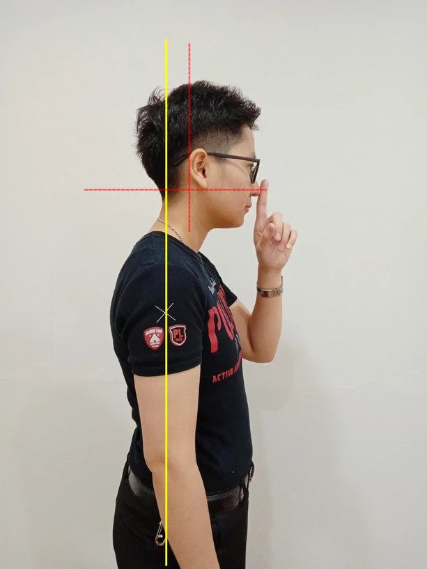 เปลี่ยนพฤติกรรมจะไม่ปวดคอเรื้อรัง