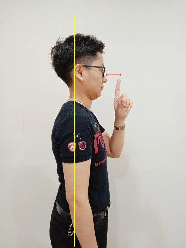 เปลี่ยนพฤติกรรมจะไม่ปวดคอเรื้อรัง