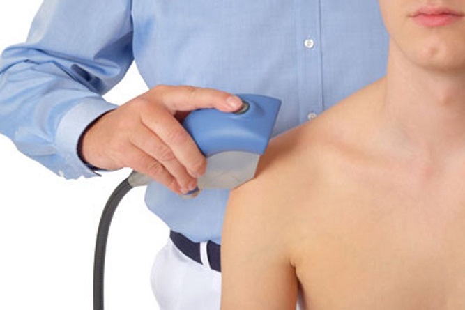 เอ็นข้อไหล่ด้านหน้าอักเสบ (Subscapularis Tendinitis)