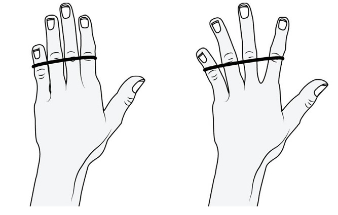 TENNIS ELBOW ปวดศอกด้านนอก อาการที่ไม่ได้เกิดขึ้นเฉพาะกับนักเทนนิส