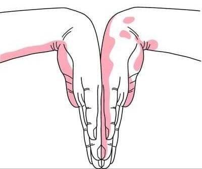 แค่นั่งทำงานหน้าคอพิวเตอร์แล้วมีอาการร้าวลงแขนชามือ