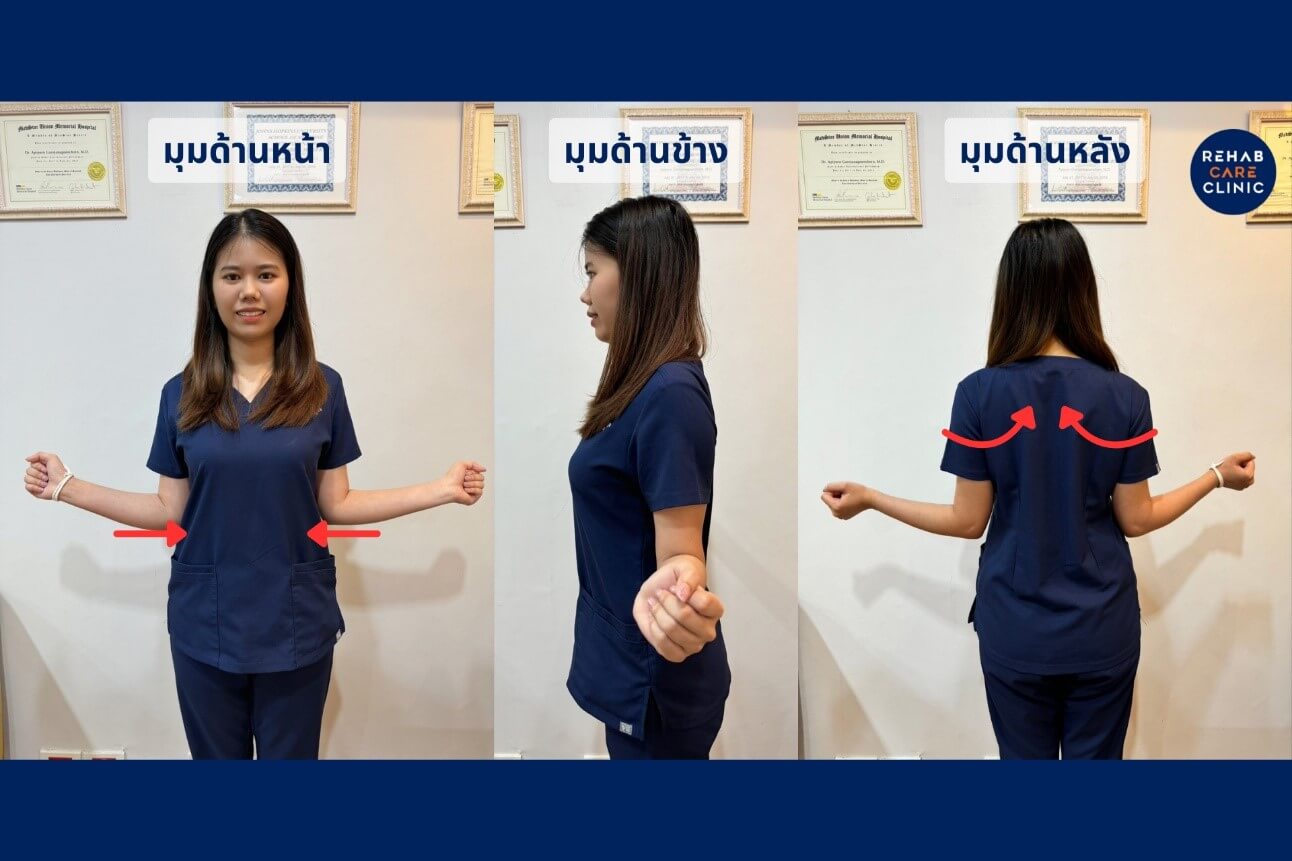 ไหล่ห่อ คอยื่น หลังค่อม ภาวะที่ไม่ควรมองข้าม