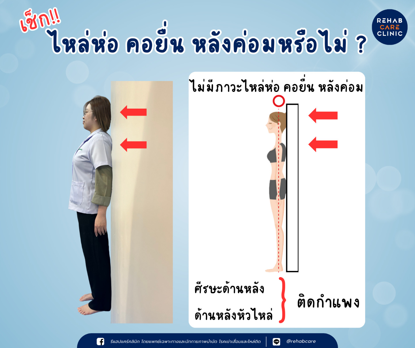 ไหล่ห่อ คอยื่น หลังค่อม ภาวะที่ไม่ควรมองข้าม