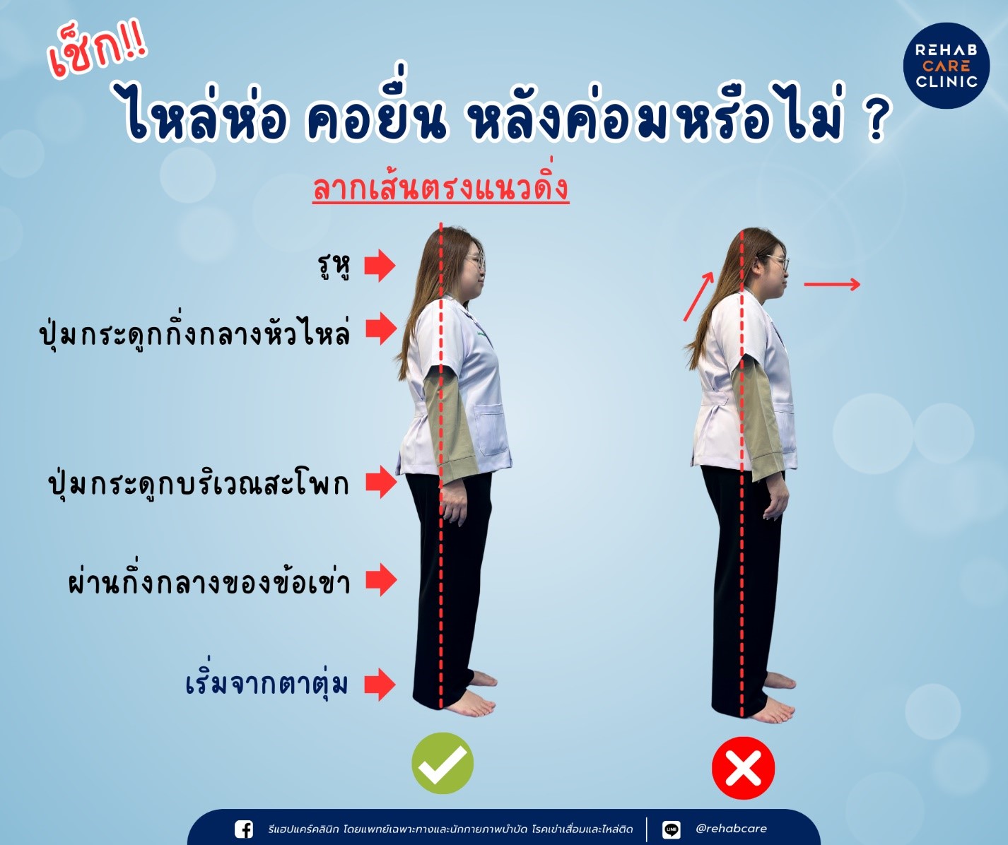 ไหล่ห่อ คอยื่น หลังค่อม ภาวะที่ไม่ควรมองข้าม