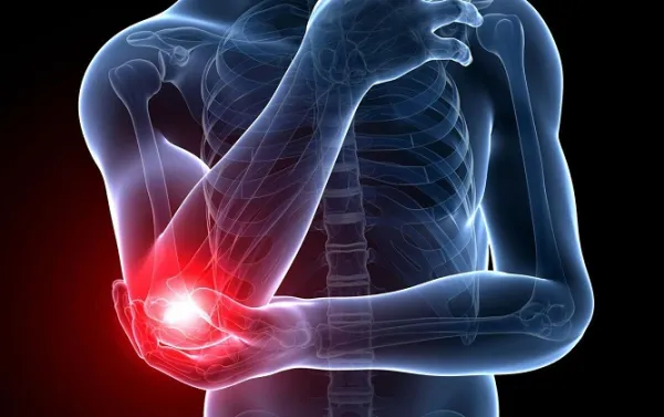 TENNIS ELBOW ปวดศอกด้านนอก อาการที่ไม่ได้เกิดขึ้นเฉพาะกับนักเทนนิส