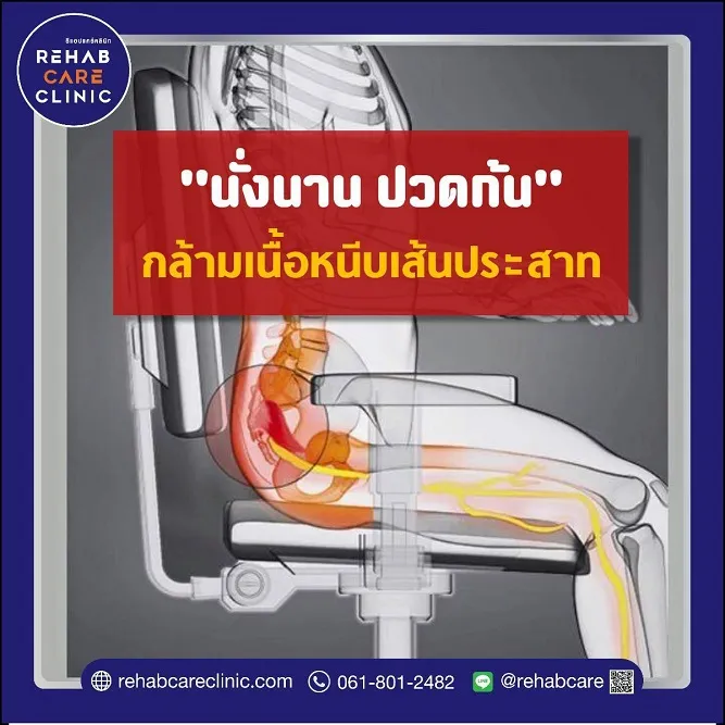 ปวดก้นชาลงขา ทานยาแก้ปวดไม่หายเกิดจากอะไรกันแน่